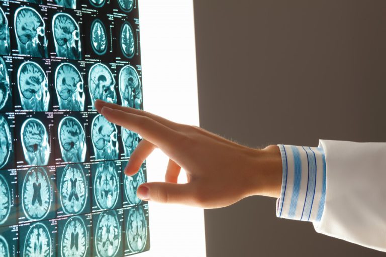 Doctor looking at brain injury patient's scans